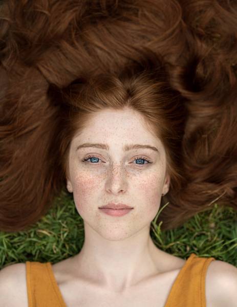 Traiter les rougeurs du visage avec une esthéticienne à gradignan proche de bordeaux