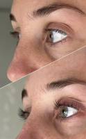 Notre zone d'activité pour ce service Réservez un soin visage anti-acné avec votre esthéticienne à domicile à